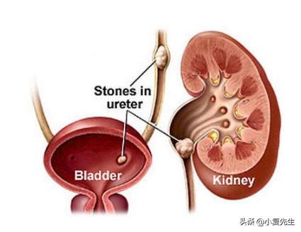 早期症状图片（皮肤癌早期症状图片）